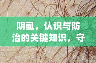 阴虱，认识与防治的关键知识，守护健康必备！