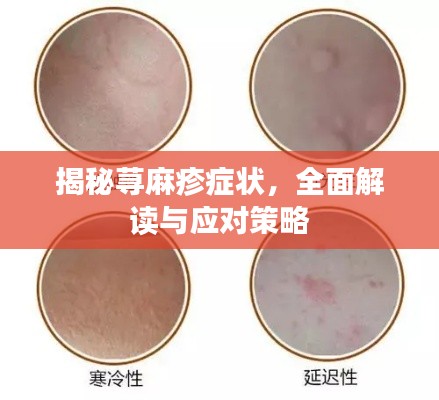 揭秘荨麻疹症状，全面解读与应对策略