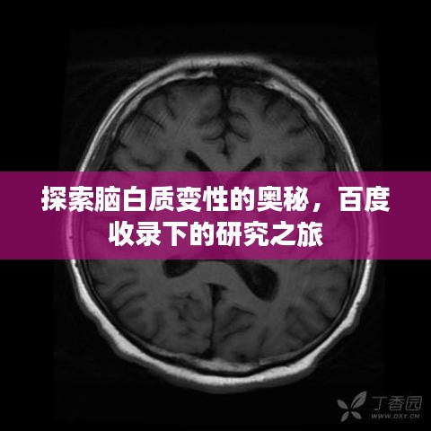 探索脑白质变性的奥秘，百度收录下的研究之旅