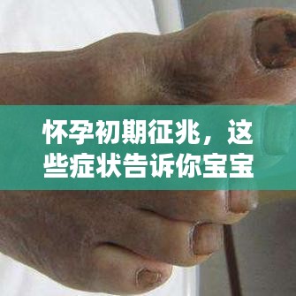 怀孕初期征兆，这些症状告诉你宝宝来了