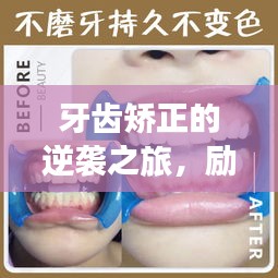 牙齿矫正的逆袭之旅，励志之路，重塑自信微笑