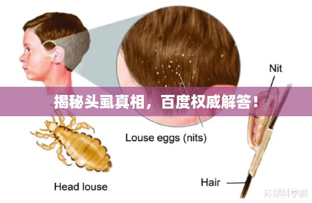 揭秘头虱真相，百度权威解答！